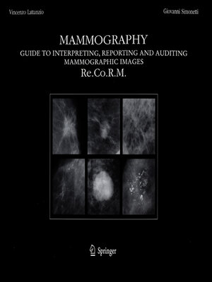 cover image of Mammography